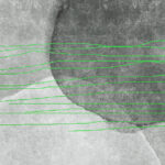u78579v3p